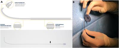 Preliminary Experience With the New Amplatzer™ Trevisio™ Delivery System in Transcatheter Atrial Septal Defect Closures in Children